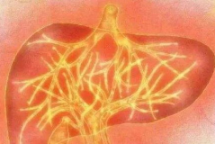 肝火旺盛有什么症状,揭秘身体不适的警示信号